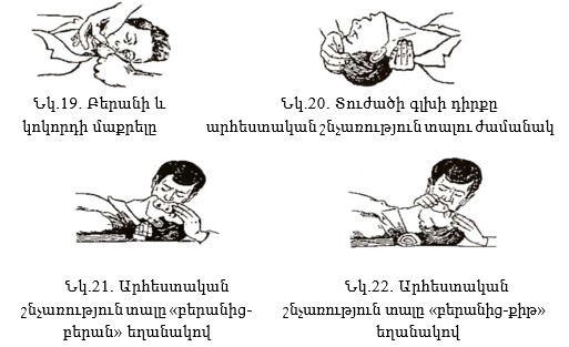 Ներմուծեք նկարագրությունը_22749